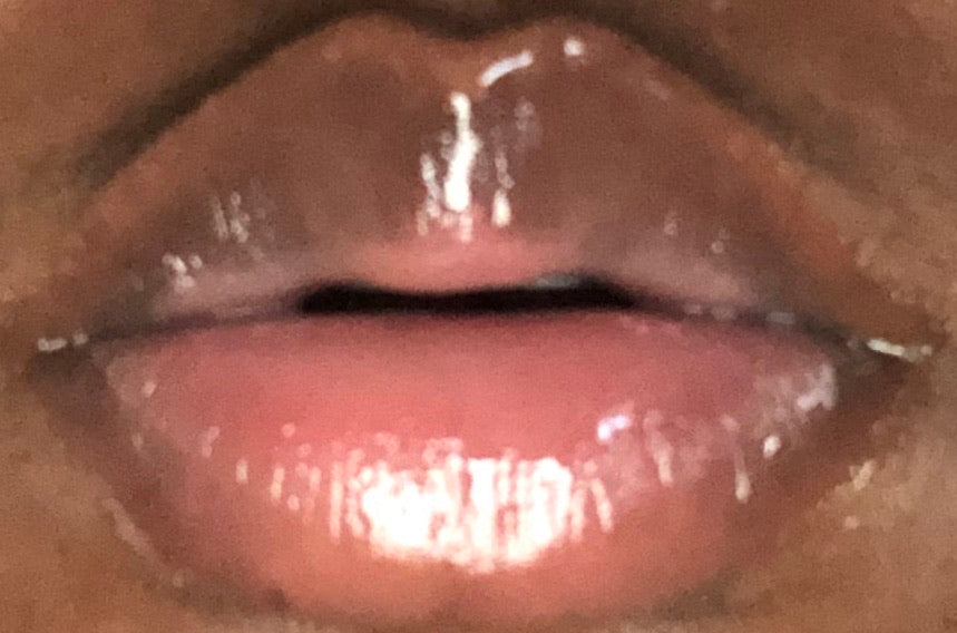 Honey Pineapple Lip Balm